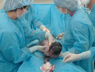 Bác sĩ sản khoa cắt cụt ngón tay trẻ sơ sinh khi mổ bắt con